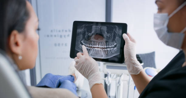 Licensed Dental Veneers service in Cottonwood Shores, TX - Smile Center Dentistry